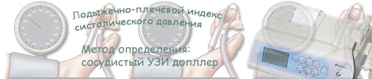 измерение лодыжечного индекса давления